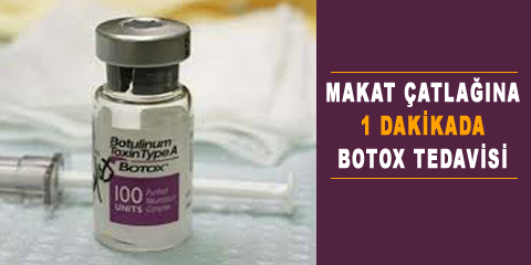 makat-catlagi-botox-tedavisi
