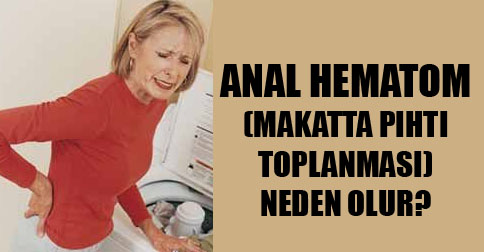 anal-hematom